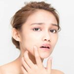 6 Penyebab Munculnya Komedo Putih yang Sering Diabaikan