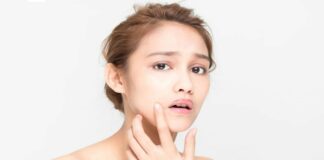 6 Penyebab Munculnya Komedo Putih yang Sering Diabaikan