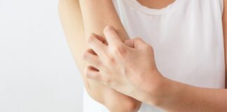 5 Bedak Gatal Yang Ampuh Redakan Gatal dan Aman untuk Kulit