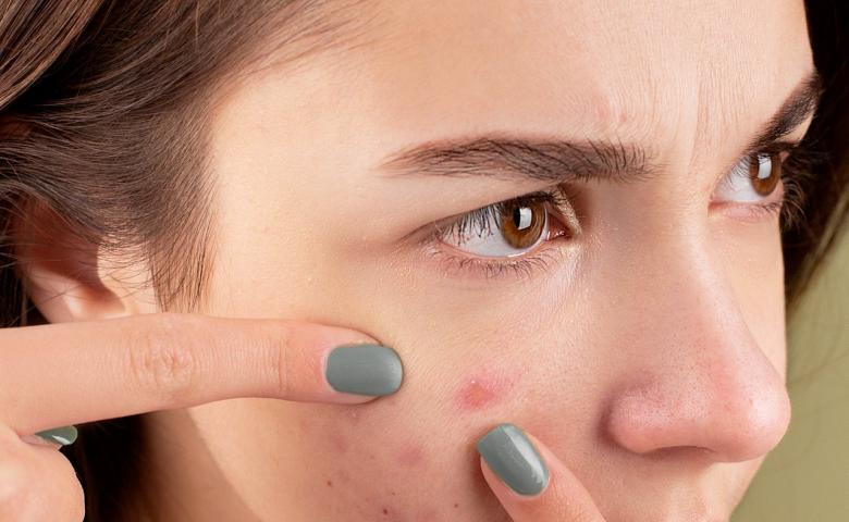 Manfaat Acnes Spot Care