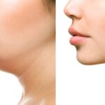 6 Cara Menghilangkan Double Chin, Miliki Wajah V-Shape!