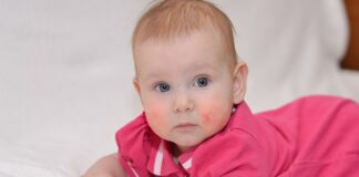 Penyebab Bintik Merah pada Bayi dan Cara Menghilangkannya