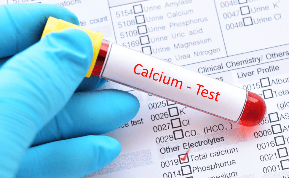 obat obatan untuk mengembalikan kadar kalsium dalam darah