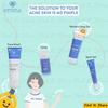 Gambar Emina Ms Pimple Acne Solution Series Face wash Moisturizing Toner Spot - Face Wash 50ml dari Find It Store Kota Surabaya 2 Tokopedia