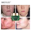 Gambar BREYLEE Acne Complete Set - Paket Perawatan Wajah Berjerawat (7pcs) dari BREYLEE INDONESIA Jakarta Utara 5 Tokopedia