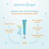 Gambar DERMA ANGEL Acne Gel 10 gr dari Gie273 Kab. Tangerang 2 Tokopedia
