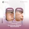 Gambar Lavees Cosmedics Concentrate Glowhite Serum Essence dari Lavees Beauty Kota Depok 3 Tokopedia