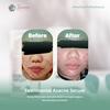 Gambar Lavees Cosmedics Azacne Serum dari Lavees Beauty Kota Depok 4 Tokopedia
