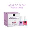 Gambar Scarlett Whitening Serum (BPOM ORI) - Acne Serum dari MPGAME Kota Tangerang 8 Tokopedia