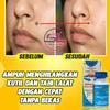 Gambar Swiss Paris Lotion Asli Penghilang Tahi Lalat dan Kutil Tanpa Operasi dari Siskalapak Kab. Lumajang 3 Tokopedia