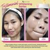 Gambar Ms Glow Whitening Series Pemutih Wajah Permanen Pencerah Wajah Aman dari Biliva Kota Surabaya 5 Tokopedia