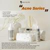 Gambar Paket Acne MS GLOW ( Solusi Wajah Berjerawat ) dari Toko Skincare Indonesia Jakarta Barat 2 Tokopedia