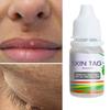 Gambar Obat Penghilang Kutil, Tahi lalat, Papiloma, Daging Tumbuh, SKIN TAG dari Suplier Good Looking Kota Bandung 2 Tokopedia
