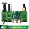 Gambar BREYLEE Blackhead & Acne Set - Pembersih Komedo & Jerawat (4 Pcs) dari BREYLEE INDONESIA Jakarta Utara 1 Tokopedia