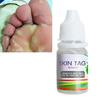 Gambar Obat Penghilang Kutil, Tahi lalat, Papiloma, Daging Tumbuh, SKIN TAG dari Suplier Good Looking Kota Bandung 3 Tokopedia