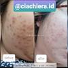 Gambar GYEOL LEMONA 2 NANO COLLAGEN POWDER + VITAMIN C (1pax isi 10 sachet) - Red (500mg), 1 pak dari Ciachiera_id Jakarta Utara 4 Tokopedia