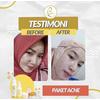 Gambar bebwhitec acne series bpom HALAL dari LauV_OS Kota Tangerang 3 Tokopedia