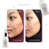 Gambar Ceramide + Ginseng Skinbar Serum (for skin barrier) dari DATGLOWSKIN Jakarta Selatan 5 Tokopedia