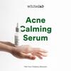 Gambar WHITELAB ACNE CALMING SERUM dari Whitelab Store Surabaya Kota Surabaya 1 Tokopedia