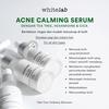 Gambar WHITELAB ACNE CALMING SERUM dari Whitelab Store Surabaya Kota Surabaya 2 Tokopedia