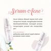 Gambar Ms Glow Acne Serum Penghilang Jerawat Ampuh Pemutih Wajah BPOM dari Biliva Kota Surabaya 5 Tokopedia