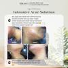 Gambar Teratu Beauty Intensive Acne Solutions Totol Jerawat TeratuBeautyBogor dari Teratu Beauty Agen Bogor Kab. Bogor 3 Tokopedia