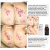 Gambar Teratu Beauty Intensive Acne Solutions Totol Jerawat TeratuBeautyBogor dari Teratu Beauty Agen Bogor Kab. Bogor 5 Tokopedia