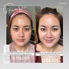 Gambar Teratu Beauty Skin Barrier Serum TeratuBeautyBogor dari Teratu Beauty Agen Bogor Kab. Bogor 4 Tokopedia