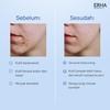 Gambar Twinpack Erha Acneact ACSBP BHA & Sulfur 60g - Sabun Wajah Jerawat dari Erha Skincare Official Jakarta Barat 4 Tokopedia