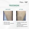 Gambar Green Angelica Hair Removal - Perontok Bulu Cair - 35ml dari GreenAngelica Official 5 Tokopedia