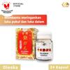 Gambar Nan Fung - Oleska Kapsul obat untuk luka memar dari CITRA DELI KREASITAMA Jakarta Barat 1 Tokopedia