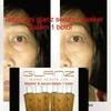 Gambar GLANZ NANO ACTIVE dari Lyracious Beauty Care Kota Bandung 1 Tokopedia