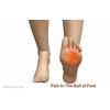 Gambar Metatarsal protector (gel pelindung tapak kaki) dari NoSant Kab. Tangerang 3 Tokopedia
