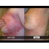 Gambar Sabun ZUDAIFU obat eksim Psoriasis jerawat jamur ruam kudis kurap dari MayCO Jakarta Selatan 5 Tokopedia