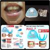Gambar TRAINER ALIGNMENT - ORTHODENTIC RETAINER TEETH - PERATA PERAPI GIGI - Biru Muda dari rumahcantiq Kota Surabaya 1 Tokopedia