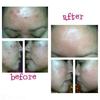 Gambar cream malam jerawat / krem jerawat / Lavees Acne night cream 10gr dari lavees skin health care Kota Bekasi 3 Tokopedia