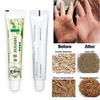 Gambar Zudaifu Original Cream Untuk Eksim Psoriasis Dermatitis Eksim J8U5 dari Alanna_Store Kota Tangerang Selatan 1 Tokopedia