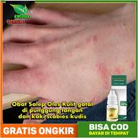 Jual Kudis Di Kaki Terlengkap Harga Murah November 2021