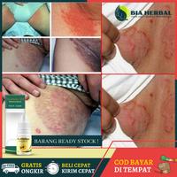 Jual Obat Jamur Selangkangan Di Depok Harga Terbaru 2021