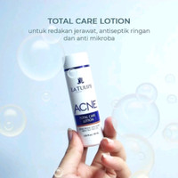 [BISA COD] La Tulipe Acne Total Care  Lotion 60 Ml