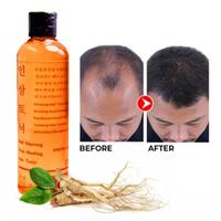 Murah!! Red Ginseng Hair Tonic / Hair Tonic Ginseng Penumbuh Rambut