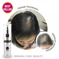 Dermagift hair tonic- Serum penumbuh rambut 2x lebih efektif dari