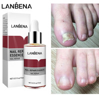 New Repair Essence Fungal Treatment Remove Onychomycosis Toe Nourishing Brightening And Foot