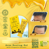 Promo EfiCare Propolis Acne Treartment by Kebun Efi Berkualitas