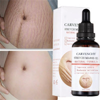 Stretch Marks Remover Essential Oil Pregnancy Maternity Body New Old