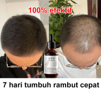 Terbaru Serum penumbuh rambut penumbuh rambut cepat Anti rambut rontok serum rambut rontok perawatan rambut rontok 60ml