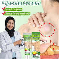 Lipoma Cream Obat Benjolan Lipoma Krim Benjolan Di Leher Tangan Ketiak Benjolan Di Leher Punggung Pundak Kaki Selangkangan Telinga Gondok Hipertiroid Kelenjar Tiroid Limfoma Limpoma Kelenjar Obat Herbal 20g