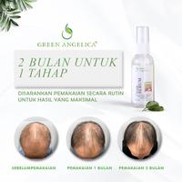 vitamin anti dht green angelica