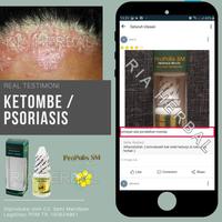 Gambar Obat Borok Di Kepala Tradisional,Pembasmi Jamur Pada Kulit,Bisul,Budug dari Ria Herbal Official undefined 2 Tokopedia