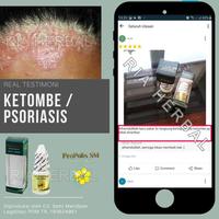 Gambar Obat Borok Di Kepala Tradisional,Pembasmi Jamur Pada Kulit,Bisul,Budug dari Ria Herbal Official undefined 5 Tokopedia